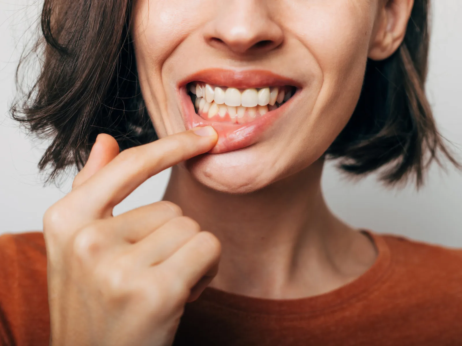 Gingii inflamate - Hello Clinic Buzău