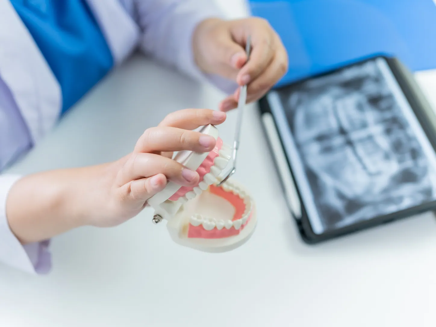 Proteza fixată pe implant dentar - Hello Clinic Buzău